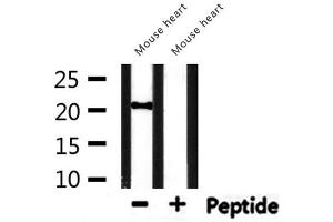 Western blot analysis of extracts from mouse heart, using CBX5 Antibody. (CBX5 Antikörper  (Internal Region))