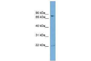 WB Suggested Anti-GFPT2 Antibody Titration:  0. (GFPT2 Antikörper  (N-Term))