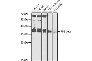 Western blot analysis of extracts of various cell lines, using PP1 beta antibody (ABIN6128486, ABIN6146055, ABIN6146057 and ABIN6217560) at 1:1000 dilution. (PPP1CB Antikörper  (AA 1-327))