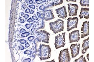 anti-Cytochrome P450, Family 2, Subfamily D, Polypeptide 6 (CYP2D6) (AA 315-347) antibody