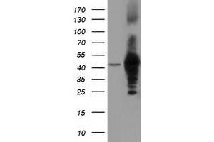 HEK293T cells were transfected with the pCMV6-ENTRY control (Left lane) or pCMV6-ENTRY DNAJA2 (Right lane) cDNA for 48 hrs and lysed. (DNAJA2 Antikörper)