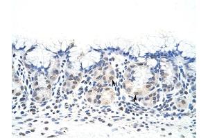 DAZ4 antibody was used for immunohistochemistry at a concentration of 4-8 ug/ml to stain Epithelial cells of fundic gland (arrows) in Human Stomach.