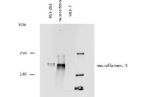 Western blotting analysis of human neurofilament H protein using mouse monoclonal antibody NF-05 on lysates of HEK-293 cell line, human brain lysate, and MCF-7 cell line (neurofilament non-expressing cell line, negative control) under reducing conditions. (NEFH Antikörper)