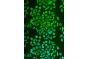 Immunofluorescence analysis of U2OS cell using PIP antibody. (PIP Antikörper)