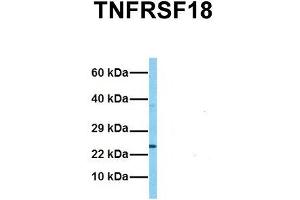 Host:  Rabbit  Target Name:  TNFRSF18  Sample Tissue:  Human HCT116  Antibody Dilution:  1. (TNFRSF18 Antikörper  (C-Term))