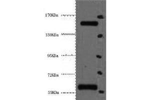 Western Blot analysis of Hela cells using CD45 Monoclonal Antibody at dilution of 1:2000. (CD45 Antikörper)
