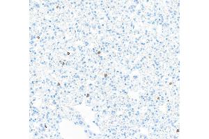 Immunohistochemistry (IHC) image for anti-CD8a Molecule (CD8A) (AA 28-194) antibody (ABIN7453877)