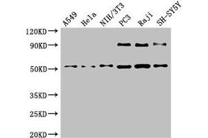 Western Blot Positive WB detected in: A549 whole cell lysate, Hela whole cell lysate, NIH/3T3 whole cell lysate, PC-3 whole cell lysate, Raji whole cell lysate, SH-SY5Y whole cell lysate All lanes: BECN1 antibody at 4 μg/mL Secondary Goat polyclonal to rabbit IgG at 1/50000 dilution Predicted band size: 52 kDa Observed band size: 52 kDa (Beclin 1 Antikörper  (AA 1-100))