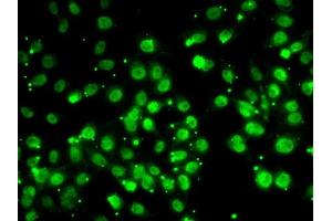 Immunofluorescence analysis of MCF7 cells using QKI antibody (ABIN6128587, ABIN6146533, ABIN6146534 and ABIN6222826). (QKI Antikörper  (AA 1-341))