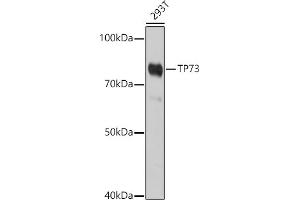 Western blot analysis of extracts of 293T cells, using TP73 antibody (ABIN6133470, ABIN6149430, ABIN6149431 and ABIN6213831) at 1:1000 dilution. (Tumor Protein p73 Antikörper  (AA 1-100))