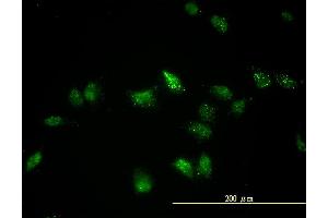 Immunofluorescence (IF) image for anti-Transcription Factor EB (TFEB) (AA 1-476) antibody (ABIN563503)