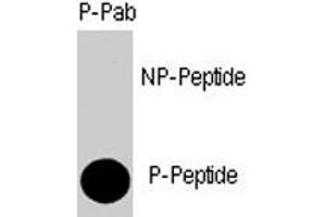 Dot blot analysis of SMAD4 (phospho T277) polyclonal antibody  on nitrocellulose membrane. (SMAD4 Antikörper  (Thr277))