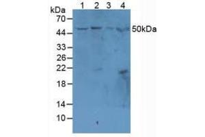 Figure. (MADCAM1 Antikörper  (AA 29-297))