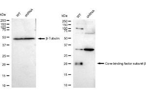 Western blotting analysis using Core-binding factor subunit beta antibody (ABIN7798155). (Rekombinanter CBFB Antikörper)