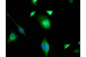 Immunofluorescence (IF) image for anti-Phosphatidylinositol-5-Phosphate 4-Kinase, Type II, gamma (PIP4K2C) (AA 127-408) antibody (ABIN7163202)