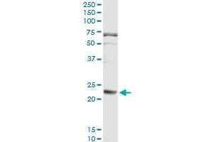 FGA (Human) IP-WB Antibody Pair