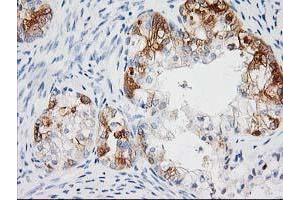 Image no. 9 for anti-BAI1-Associated Protein 2 (BAIAP2) antibody (ABIN1496805) (BAIAP2 Antikörper)