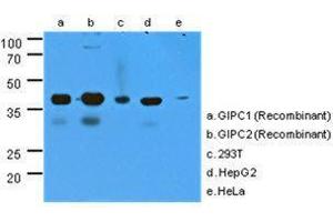 The cell lysates (40 ug) were resolved by SDS-PAGE, transferred to PVDF membrane and probed with GIPC antibody (1:1000).