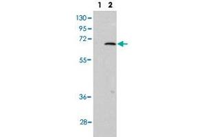Western blot analysis of PIAS1 (arrow) using PIAS1 polyclonal antibody . (PIAS1 Antikörper  (C-Term))