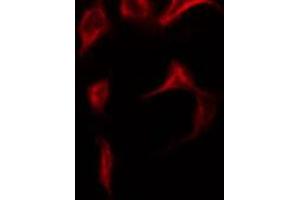 ABIN6269120 staining NIH-3T3 by IF/ICC. (c-MET Antikörper  (Internal Region))