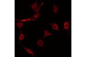 ABIN6274922 staining COLO205 by IF/ICC. (FAM203B Antikörper  (Internal Region))
