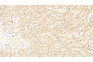 Detection of HNF4a in Human Liver Tissue using Polyclonal Antibody to Hepatocyte Nuclear Factor 4 Alpha (HNF4a) (HNF4A Antikörper  (AA 131-330))