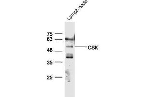 Mouse lymph node lysates probed with Anti-CSK Polyclonal Antibody, Unconjugated  at 1:5000 for 90 min at 37˚C. (CSK Antikörper  (AA 301-400))