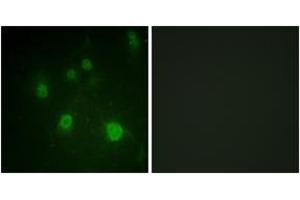 Immunofluorescence analysis of COS7 cells, using HMG14 (Phospho-Ser21) Antibody. (HMGN1 Antikörper  (pSer21))