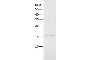 Western Blotting (WB) image for Enhancer of Split m8 Protein (E(SPL)M8-HLH) (AA 1-197) protein (His tag) (ABIN7122784) (Enhancer of Split m8 Protein (E(SPL)M8-HLH) (AA 1-197) protein (His tag))
