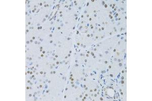 Immunohistochemistry of paraffin-embedded mouse pancreas using SNRNP70 antibody. (SNRNP70 Antikörper  (AA 150-250))