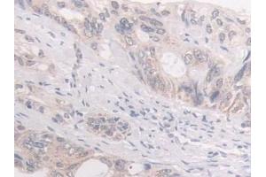 Immunohistochemistry (IHC) image for anti-FK506 Binding Protein 4, 59kDa (FKBP4) (AA 2-459) antibody (ABIN7441208)