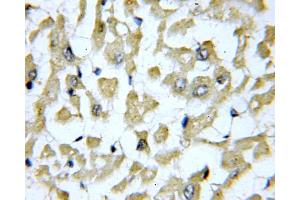 IHC analysis of paraffin-embedded human heart tissue, using SLN antibody (1/100 dilution, 40X lens). (SLN Antikörper)