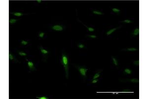 Immunofluorescence of monoclonal antibody to PDX1 on HeLa cell. (PDX1 Antikörper  (AA 109-208))