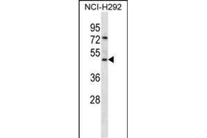 GP2 Antibody (N-term) (ABIN657047 and ABIN2846214) western blot analysis in NCI- cell line lysates (35 μg/lane). (GP2 Antikörper  (N-Term))