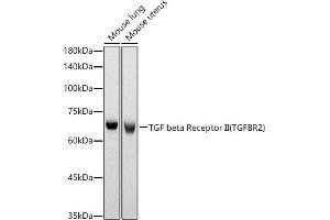 Western blot analysis of extracts of various cell lines, using TGF beta Receptor II (TGFBR2) antibody (ABIN6130736, ABIN6149086, ABIN6149089 and ABIN6218416) at 1:630 dilution. (TGFBR2 Antikörper  (AA 23-280))