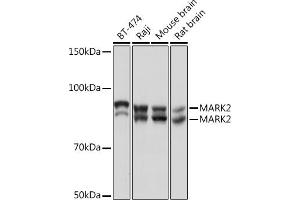 Western blot analysis of extracts of various cell lines, using M Rabbit mAb (ABIN7268397) at 1:1000 dilution. (MARK2 Antikörper)