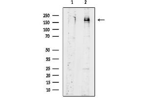 Western blot analysis of lysates from serum starvation treated MCF7 cells, using Phospho-HER2 (Tyr1248) Antibody.