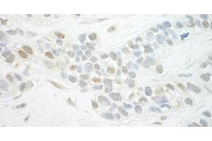 anti-Mediator Complex Subunit 13-Like (MED13L) (AA 750-800) antibody