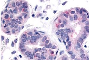 Anti-HUNK antibody  ABIN1048970 IHC staining of human breast. (HUNK Antikörper  (Internal Region))