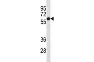 Alkaline Phosphatase Antikörper  (AA 56-83)