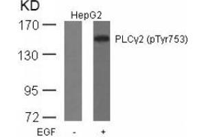 Image no. 1 for anti-Phospholipase C gamma 2 (PLCG2) (pTyr753) antibody (ABIN196906) (Phospholipase C gamma 2 Antikörper  (pTyr753))