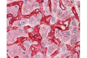 Immunohistochemistry (IHC) image for anti-C-Type Lectin Domain Family 4, Member M (CLEC4M) (AA 323-372) antibody (ABIN6755289)
