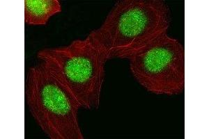 Fluorescent image of A549 cell stained with HMGA1 antibody at 1:25. (HMGA1 Antikörper  (AA 64-93))