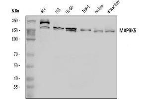 Western blot analysis of ASK1/MAP3K5 using anti-ASK1/MAP3K5 antibody (ABIN7600304).