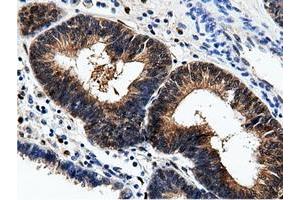Immunohistochemical staining of paraffin-embedded Human Kidney tissue using anti-AK5 mouse monoclonal antibody. (Adenylate Kinase 5 Antikörper)