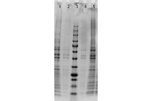 SDS-PAGE of Normal Mouse Pancreas Whole Cell Lysate. (Normal Maus Pancreas Whole Cell Lysate)