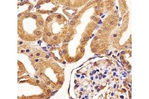 Immunohistochemistry (IHC) image for anti-Fms-Related Tyrosine Kinase 4 (FLT4) antibody (ABIN3030977)