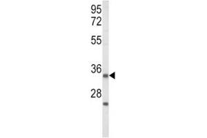 Western Blotting (WB) image for anti-Insulin-Like Growth Factor Binding Protein 2, 36kDa (IGFBP2) (AA 277-305) antibody (ABIN3031351)