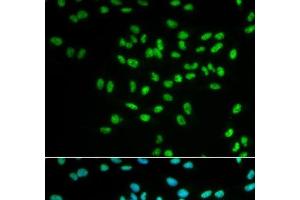 Immunofluorescence analysis of MCF-7 cells using FANCD2 Polyclonal Antibody (FANCD2 Antikörper)