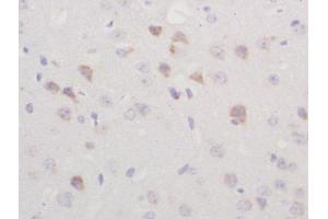 Formalin-fixed and paraffin embedded rat brain labeled with Rabbit Anti-TGM2 Polyclonal Antibody, Unconjugated  at 1:200 followed by conjugation to the secondary antibody and DAB staining (Transglutaminase 2 Antikörper  (AA 551-650))